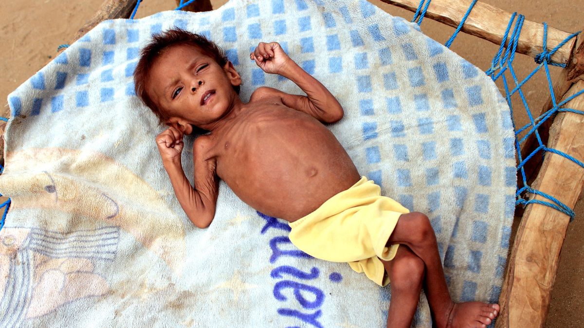 Jemenu hrozí hladomor
